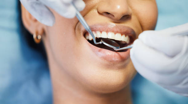 Best Knocked-Out Tooth Emergency  in North Weeki Wachee, FL