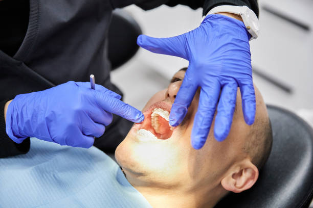 Best Urgent Tooth Repair  in North Weeki Wachee, FL